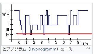 ヒプノグラム